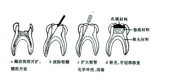成都義齒產業(yè)在國際市場上的地位如何？? | 成都義齒廠家